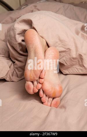 tallone nelle crepe degli strisci sulla gamba, mal di corpo, stretto spaccato. Disidratazione applicare pedicure, salute Foto Stock