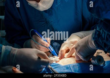 Il chirurgo tiene il coagulatore elettrico durante l'operazione. Primo piano delle mani in guanti sterili colorati con sangue. Uniforme blu e medico Foto Stock