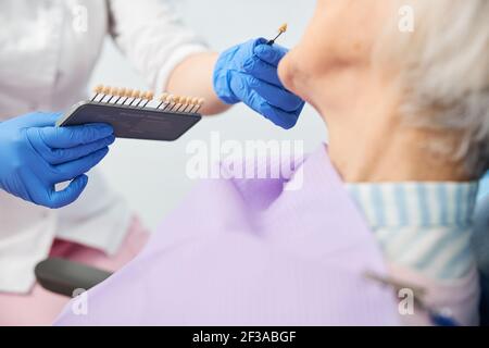 Campione di dente che aiuta nella selezione dell'ombra per sbiancare Foto Stock