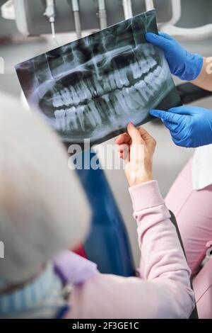 Pensionato che guarda il diagramma a raggi X dei denti Foto Stock