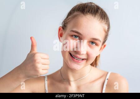 Adolescente ragazza sorridente in parentesi ortodontiche mostrando pollice in su. Ragazza con bretelle sui denti. Trattamento ortodontico. Foto Stock