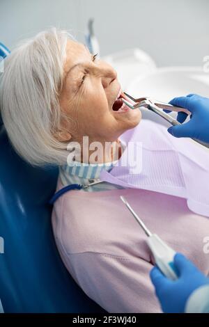 Il medico sta rimuovendo il dente superiore con il forcipe Foto Stock