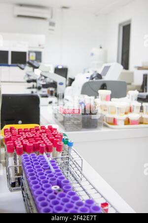 Laboratorio vuoto con microscopi e campioni di fluidi umani in provette Foto Stock