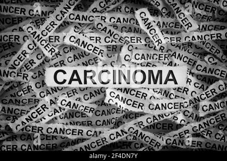 Carcinoma. Strappato pezzi di carta con le parole Carcinoma e cancro. Bianco e nero. Primo piano. Foto Stock