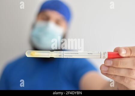 Infermiere che tiene un tubo. Test del rotavirus. Uomo che indossa una maschera facciale che afferra un campione di feci da esaminare in laboratorio Foto Stock