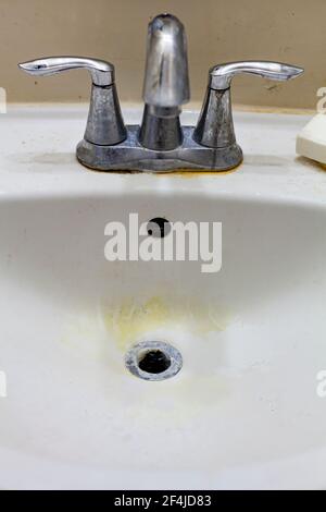Primo piano immagine di un rubinetto e lavandino in un bagno sporco. Intorno al foro di sinuo l sono visibili residui di sapone e scolorimento giallo e scuro Foto Stock