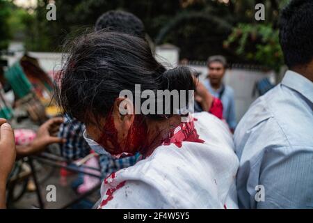 Dhaka, Dhaka, Bangladesh. 23 marzo 2021. Un manifestante dell'alleanza di studenti progressisti è ferito durante una protesta contro la prossima visita del primo ministro indiano Narendra modi in Bangladesh per partecipare alle celebrazioni del giubileo d'oro dell'indipendenza del paese, a Dhaka, in Bangladesh, il 23 marzo 2021. Credit: Zabed Hasnain Chowdhury/ZUMA Wire/Alamy Live News Foto Stock