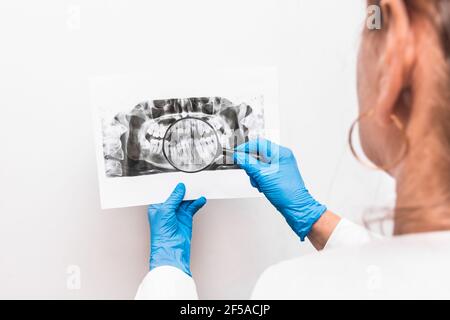 Una donna medico in guanti medici protettivi tiene una radiografia immagine dei denti nelle sue mani e lo esamina attraverso una lente d'ingrandimento su uno sfondo bianco Foto Stock