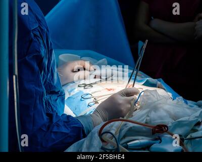 Il medico utilizza una varietà di strumenti medici per eseguire la chirurgia minimamente invasiva. Primo piano di mani macchiate di sangue in guanti sterili e. Foto Stock