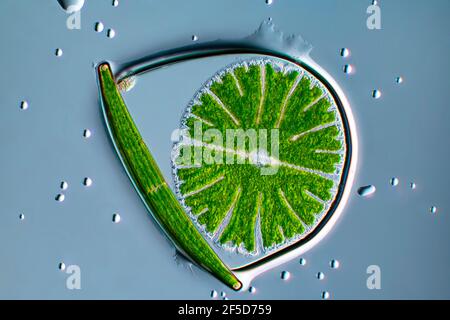 Alga verde (Micrasterias rotata), con Clostridium in una bolla d'acqua, immagine microscopica a campo scuro, ingrandimento x100 relativo a 35 mm, Germania Foto Stock