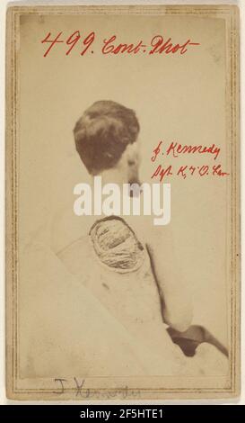 John Kennedy Sgt. Co. K. 7th Ohio Calvry. Attribuito a William H. Bell (americano, 1830 - 1910) Foto Stock
