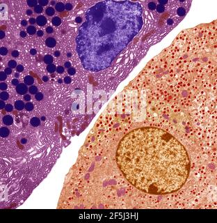 Pancreas, TEM Foto Stock
