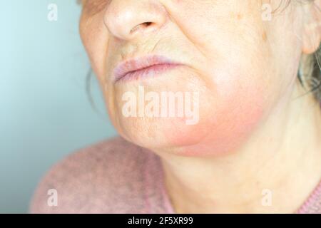 Donna matura depressa isolata su sfondo grigio studio guancia tocco sofferente di dolore dentale Foto Stock