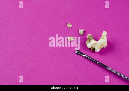 Dente animale grande, placca e raschietto dentale su sfondo magenta. Primo piano del molare di un cane che è caduto fuori. Pezzi scheggiati di tartaro. Ammaccatura PET Foto Stock