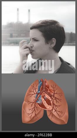 Giovane donna che usa un inalatore Foto Stock