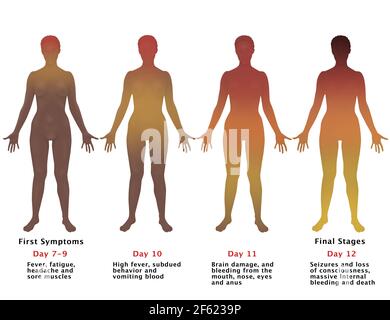 Progressione di Ebola, illustrazione Foto Stock