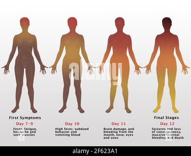 Progressione di Ebola, illustrazione Foto Stock