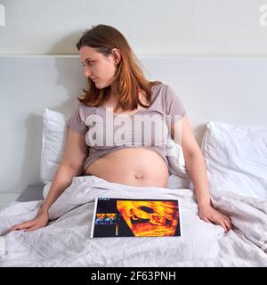 Una donna triste guarda i risultati di un ecografo per una gravidanza sdraiata nel suo letto di casa Foto Stock