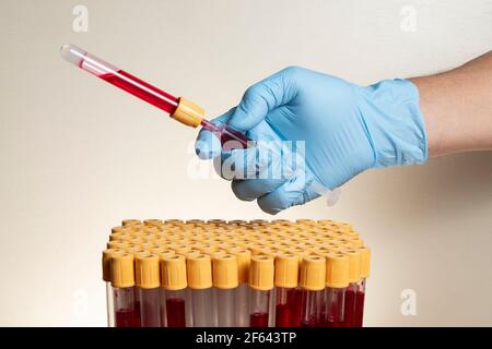 mano con guanto di protezione in nitrile contenente siringa con provette per il prelievo ematico. Foto Stock