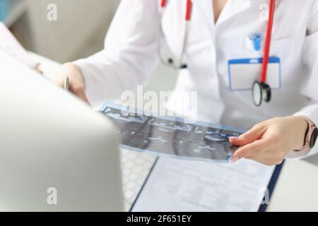 Il medico tiene in mano un'immagine radiografica del paziente Foto Stock