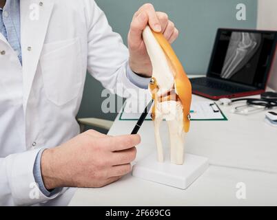 Concetto di trattamento della lesione del legamento del crogiato umano. Ortopedista che mostra di crocifigare il legamento in un modello di insegnamento medico delle articolazioni del ginocchio, primo piano Foto Stock