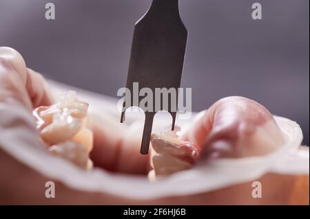 Paziente che riceve un trattamento dentistico in clinica. Foto Stock