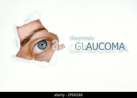 Donna`s occhio guardando trogolo lacerato buco in carta, parola Glaucoma a destra. Modello di concetto di malattia degli occhi. Sfondo bianco isolato. Foto Stock