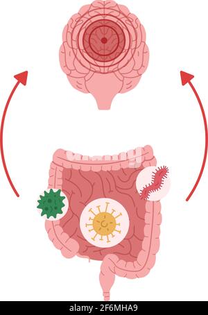 Una cattiva salute intestinale a causa dell'esposizione a microrganismi porta all'illustrazione vettoriale della neuroinfiammazione. Illustrazione Vettoriale