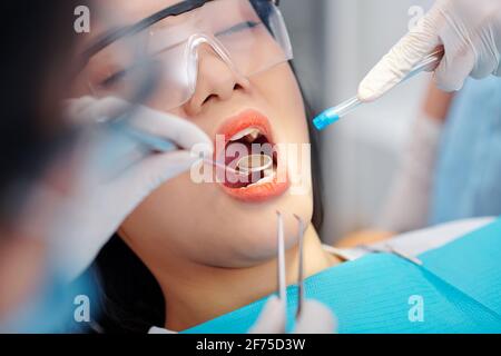 Immagine ravvicinata del dentista con esame dello specchio e dell'espulsore della saliva denti di giovane paziente femminile Foto Stock
