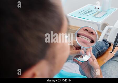 Immagine ravvicinata dell'uomo con un piccolo specchio che sorride quando si guarda ai suoi denti diritti trattati Foto Stock
