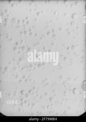 Micrografie del latte, immagazzinate in modi diversi. Ogni fotografia include circa 1/1070 cubici ecc. latte. Ingrandimento 640 volte. Foto Stock