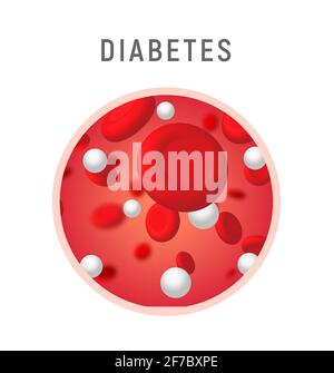 Simbolo del concetto di livello di diabete nel sangue. Glucosio insulina umana diseasazione Illustrazione Vettoriale