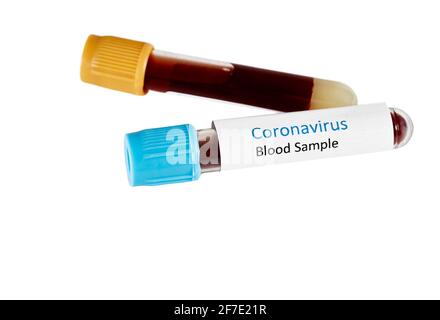 Primo piano di due fiale per campioni di sangue di Coronavirus isolate su bianco Foto Stock