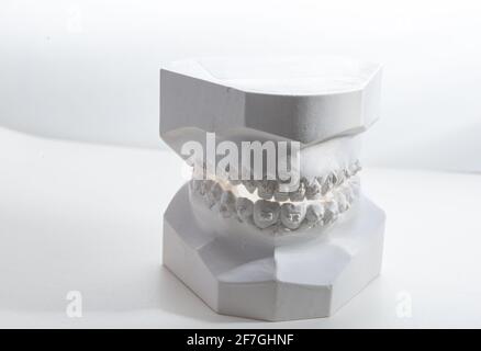 Modello dentale gesso calco o muffa mascelle umane protesiche su sfondo bianco Foto Stock