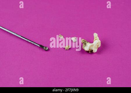 Dente animale grande, placca e raschietto dentale su sfondo magenta. Primo piano del molare di un cane che è caduto fuori. Pezzi scheggiati di tartaro. Ammaccatura PET Foto Stock