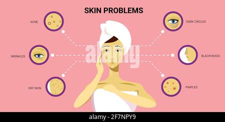 la pelle del viso pimples acne diversi tipi sul poro della faccia della donna comedones cosmetologia problemi di skincare concetto orizzontale verticale piatto Illustrazione Vettoriale