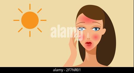 donna con pelle rossa dopo l'abbronzatura senza protezione solare ragazza con rossore da scottatura verticale orizzontale Illustrazione Vettoriale
