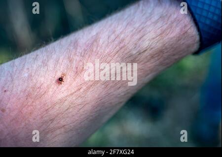 Un segno di spunta di stella solita, un vettore comune di malattie, strisciando su un braccio Foto Stock