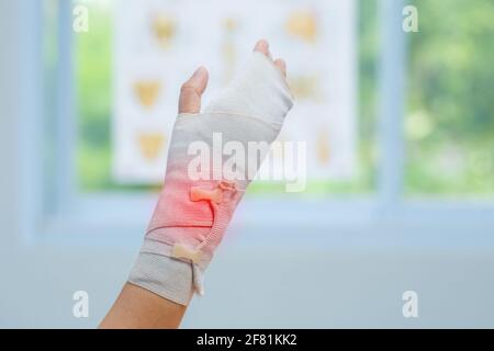 Bendaggio di legatura sul polso del paziente in clinica, osteofiti e tallone, fascia, medico ortopedico Foto Stock