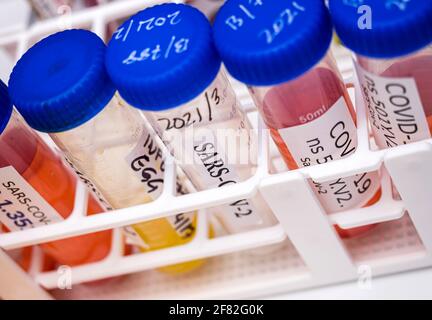 Ricerca di laboratorio nuovo ceppo di Sudafrica sars-COV-2 scientificamente conosciuto come 20H/501Y.V2 o B.1.351), quadro concettuale Foto Stock