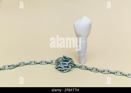 L'impianto dentale è attorcigliato con una catena metallica su uno sfondo beige. Modello di impianto dentale del dente artificiale. Concetto di odontoiatria e strumento medico Foto Stock