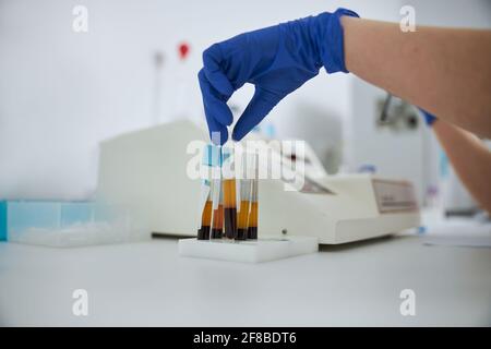 Lavoratore di laboratorio che sceglie un campione per un test di coagulazione Foto Stock