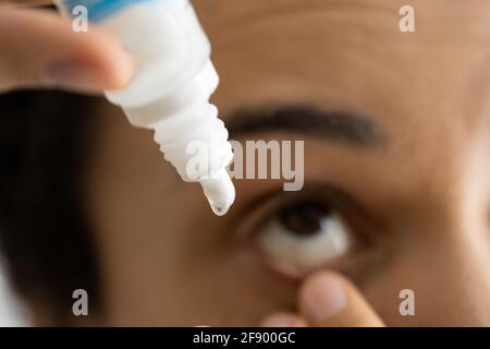 African Woman Drop farmaco oculare per glaucoma e congiuntivite Foto Stock