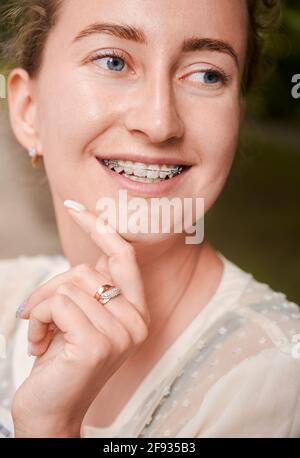 Ritratto verticale di donna di bellezza naturale, sorridente, indossando dentali in ceramica e bretelle metalliche sui denti. Guardando via. Primo piano. Concetto di medicina e odontoiatria Foto Stock