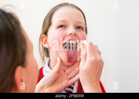 Età scolastica bambino scuola primaria ragazza di nove anni / 9 anni che ha campioni prelevati dalla gola per l'uso in un LFT di prova di flusso laterale dalla società cinese Innova. Inghilterra Regno Unito. (123) Foto Stock