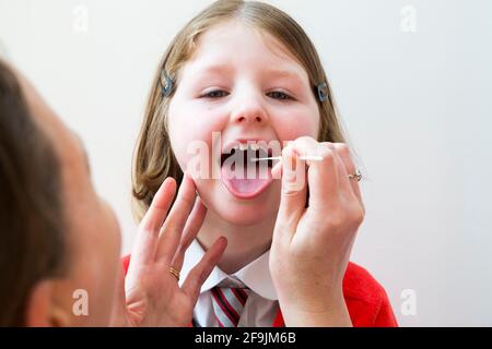 Età scolastica bambino scuola primaria ragazza di sei anni / 6 anni che ha campioni prelevati dalla gola per l'uso in un LFT di prova di flusso laterale dalla società cinese Innova. Inghilterra Regno Unito. (123) Foto Stock
