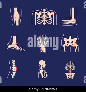 set di ossa umane di disturbo reumatologico Illustrazione Vettoriale