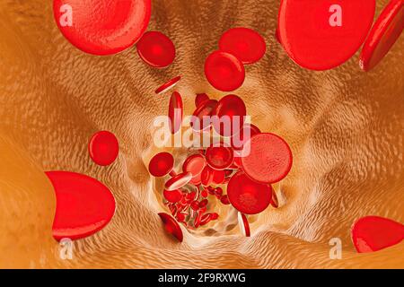 interno di una vena con colesterolo e globuli rossi Foto Stock