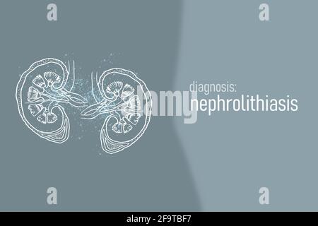 Nefrolitiasi calcoli renali malattia o urolitiasi. Calcoli renali o pietre che bloccano il tratto urinario.modello di disegno di stile minimalistico Foto Stock