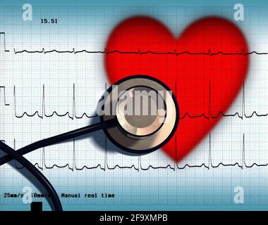 Stetoscopio ed ECG su un cuore stilizzato. Illustrazione digitale Foto Stock